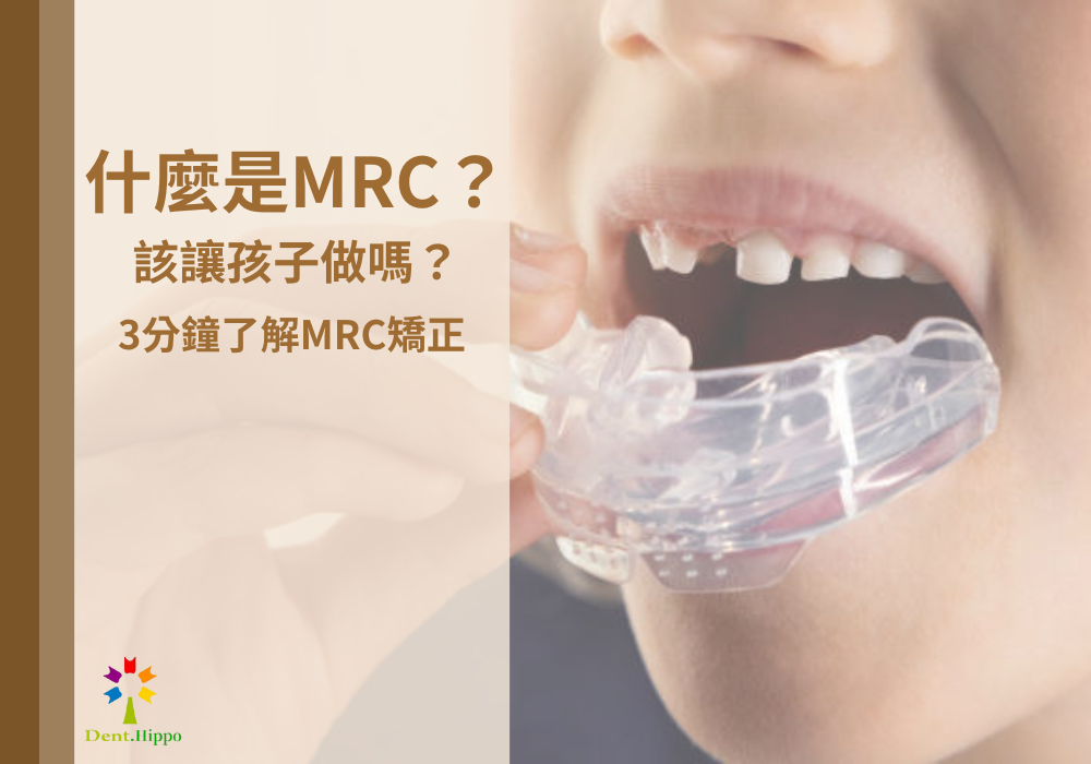 什麼是MRC(Myobrace)？該讓孩子做MRC矯正嗎？3分鐘了解MRC